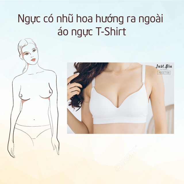 Dáng ngực nhũ hoa hướng ra ngoài